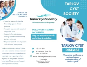 Tarlov Cyst Society Brochure with details about Tarlov Cyst Disease
