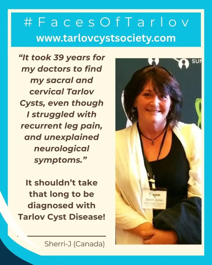 #FacesOfTarlov - S Jones